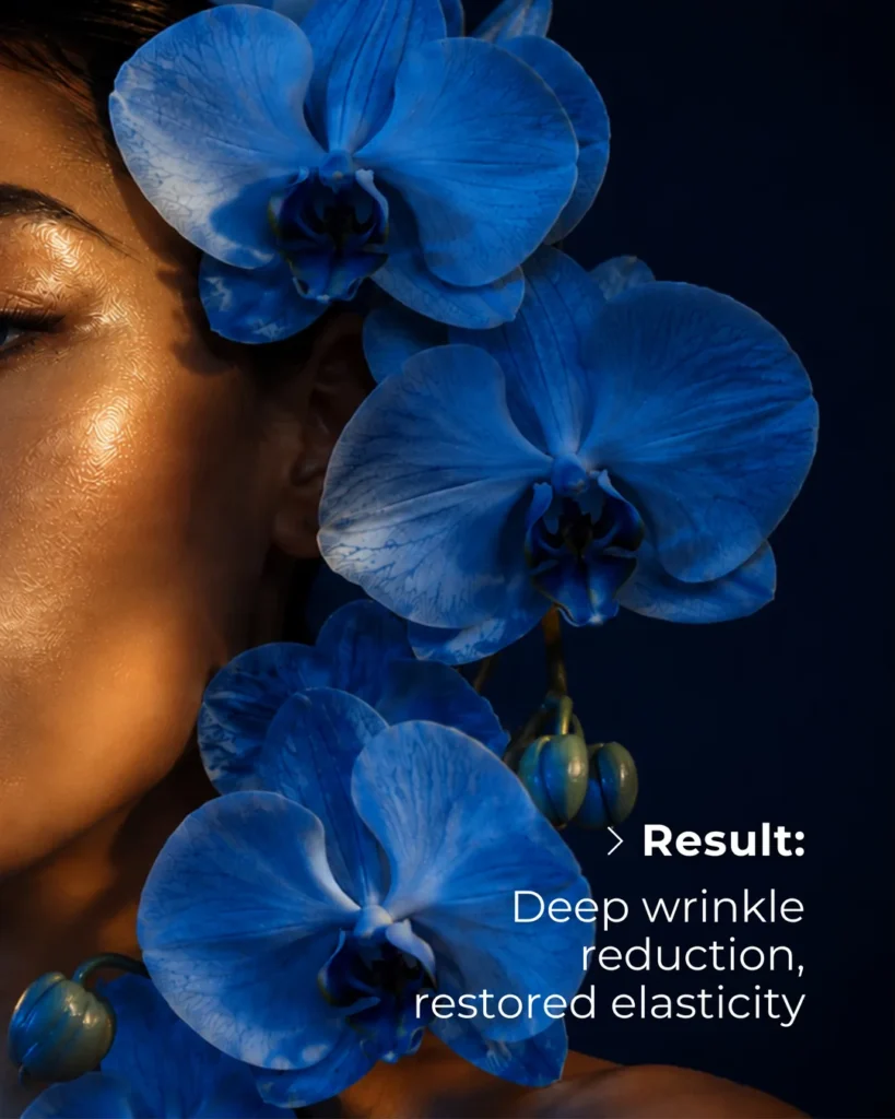 AURORA PN skin booster results – wrinkle reduction and restored elasticity Dubai